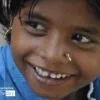 Pierced Smile, by Ryszard Wierzbicki - Photojournalism, Candid Photography, Award Winning Photography, Documentary Photography, Ryszard Wierzbicki