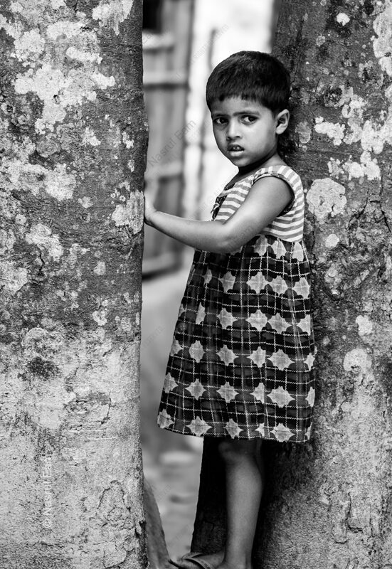 Child in Patterned Dress Between Lichen Bark